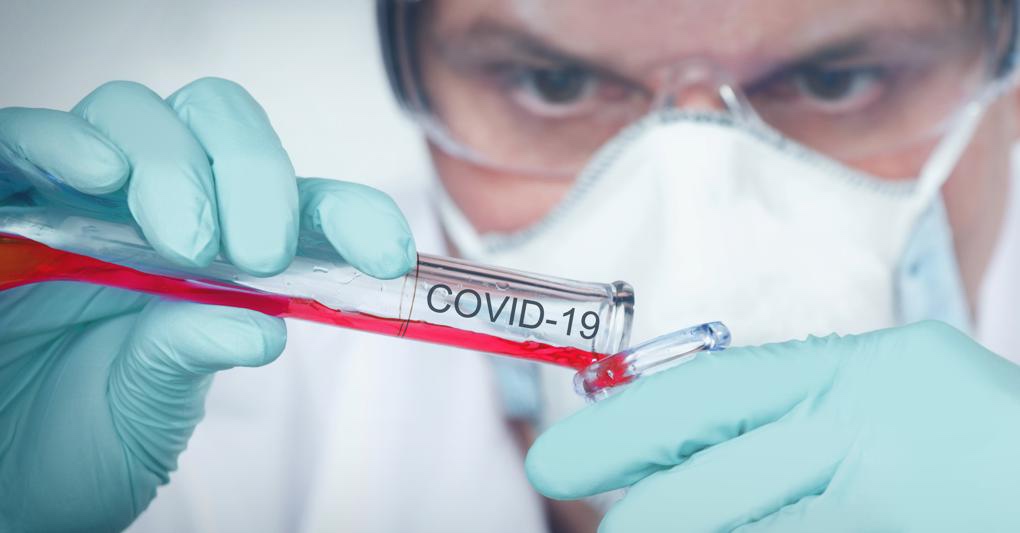 REPORTAGE – Test sul sangue effettuati in Giappone: la mortalità da coronavirus è inferiore&nbsp;all’influenza