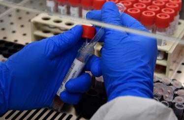 Variante Delta, in arrivo i test per&nbsp;riconoscerla