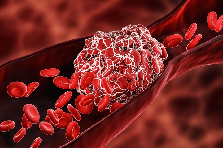 Firenze, uomo di 60 anni e donna di 59 anni colpiti da trombosi dopo il&nbsp;vaccino